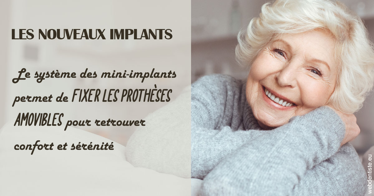 https://dr-grosman-gilles.chirurgiens-dentistes.fr/Les nouveaux implants 1