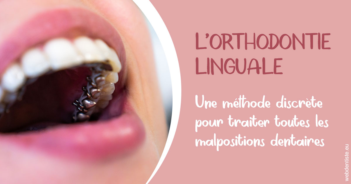 https://dr-grosman-gilles.chirurgiens-dentistes.fr/L'orthodontie linguale 2
