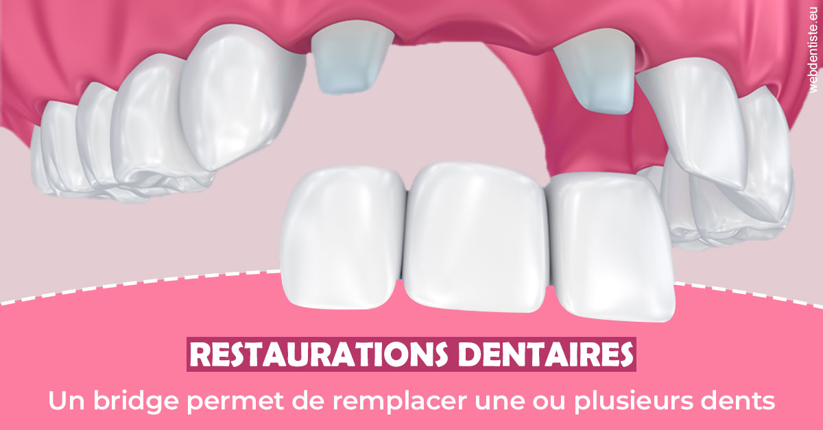 https://dr-grosman-gilles.chirurgiens-dentistes.fr/Bridge remplacer dents 2