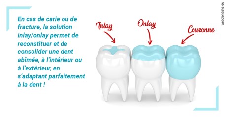 https://dr-grosman-gilles.chirurgiens-dentistes.fr/L'INLAY ou l'ONLAY