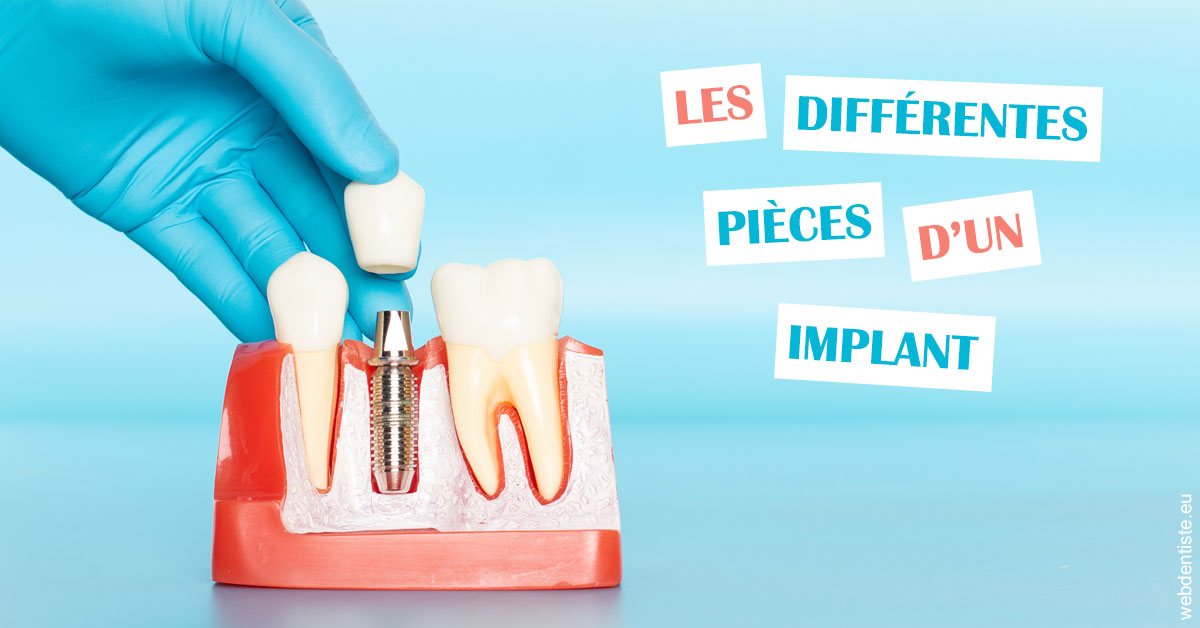 https://dr-grosman-gilles.chirurgiens-dentistes.fr/Les différentes pièces d’un implant 2