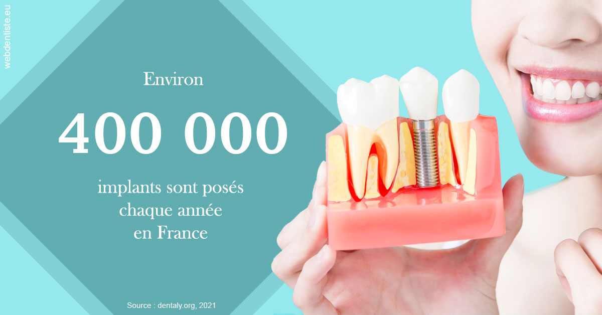 https://dr-grosman-gilles.chirurgiens-dentistes.fr/Pose d'implants en France 2