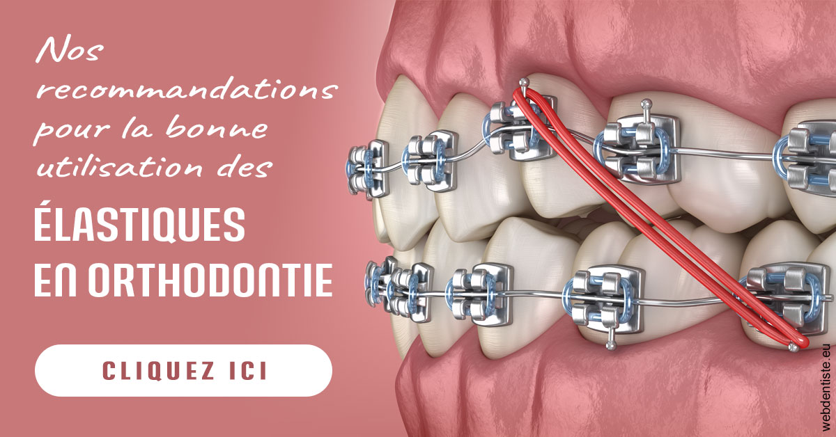https://dr-grosman-gilles.chirurgiens-dentistes.fr/Elastiques orthodontie 2